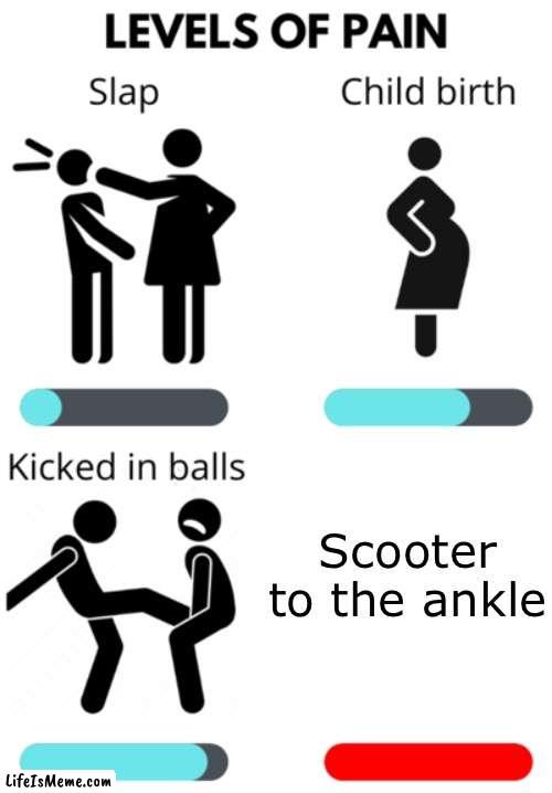 Relatable pain | Scooter to the ankle | image tagged in levels of pain,scooter | made w/ Lifeismeme meme maker
