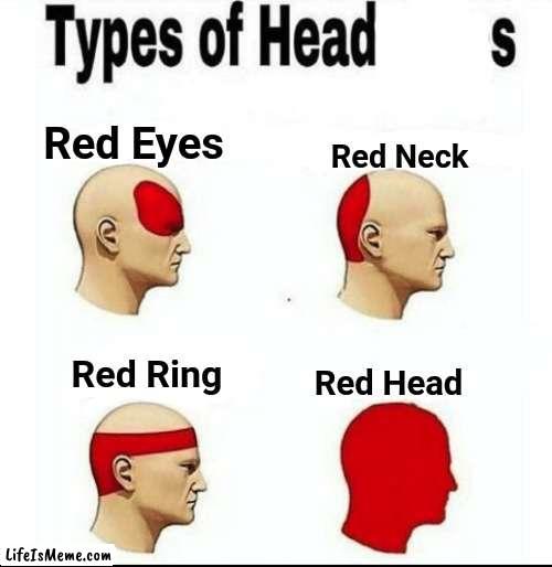 Not how to use this template #11 | Red Eyes; Red Neck; Red Ring; Red Head | image tagged in types of headaches meme | made w/ Lifeismeme meme maker